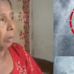 കുത്തിവെപ്പെടുത്തപ്പോള്‍ സൂചി ഒടിഞ്ഞു, ദുരിതവുമായി വത്സല കഴിഞ്ഞത് ഒരു വര്‍ഷം