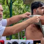 സിജെപിയുടെ പാർലമെന്റ് മാർച്ച്; പെല്ലറ്റ് ഗൺ ഉപയോഗിച്ചുള്ള ആക്രമണത്തിൽ പരുക്കേറ്റത് 5 പേർക്ക്; പരീക്ഷ ക്രമക്കേടുകൾ തടയാനുള്ള ബിൽ ഇന്ന് പാർലമെന്റിൽ